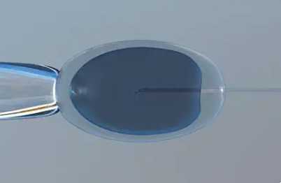 国内供卵试管婴儿私立机构,曾雯茴（关于曾雯茴介绍）