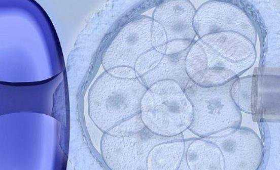 国内试管供卵的医院,脐带绕颈要重视！这5大危害并非吓唬人