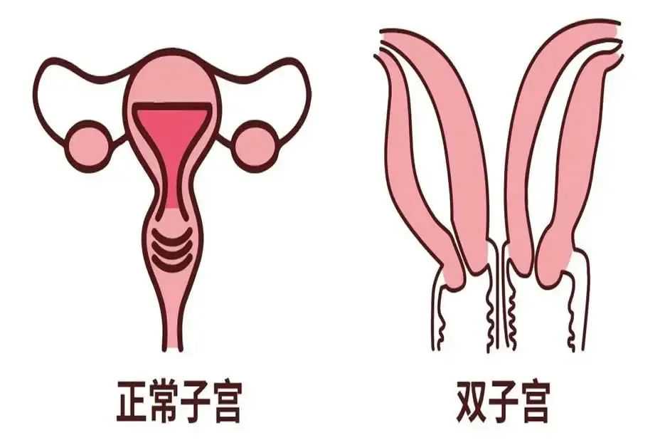 国内最可靠代怀,2026冷冻精子挂什么科、要啥手续全囊括，想留后路必看