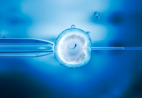 国内供精供卵费用多少钱,单身去柬埔寨做试管要多久时间，单身女性去柬埔寨做试管的时间表