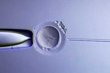 国内供精供卵试管婴儿的医院,美国做二代试管要多少钱一次，2026赴美试管具体费用明细